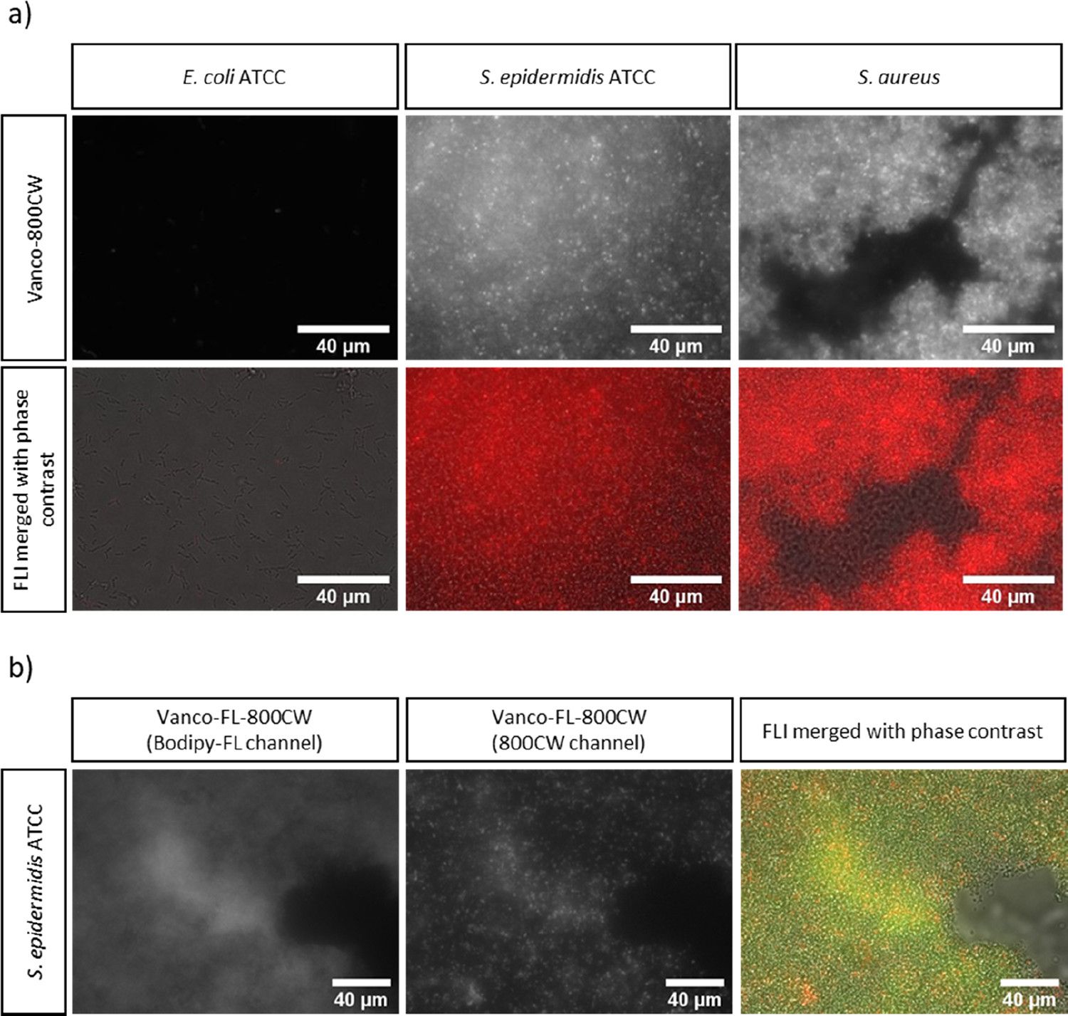 Optical and Optoacoustic imaging